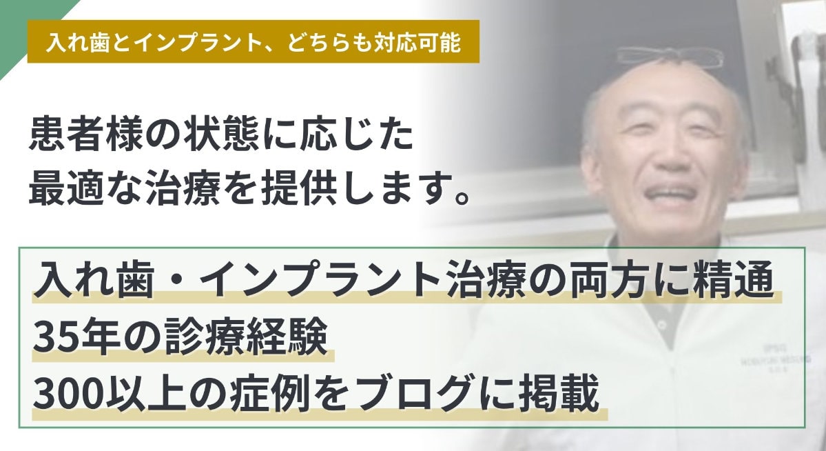 入れ歯とインプラント、どちらも対応可能