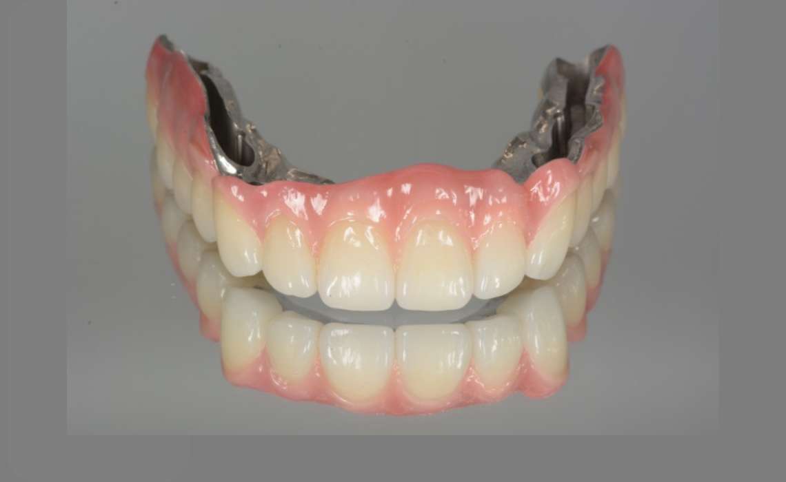 高機能な入れ歯とインプラントの選択肢があり、それに関連する基礎治療にも精通