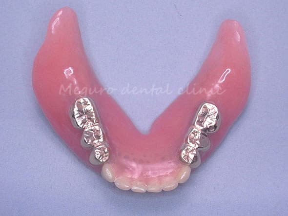 適切な形態の入れ歯